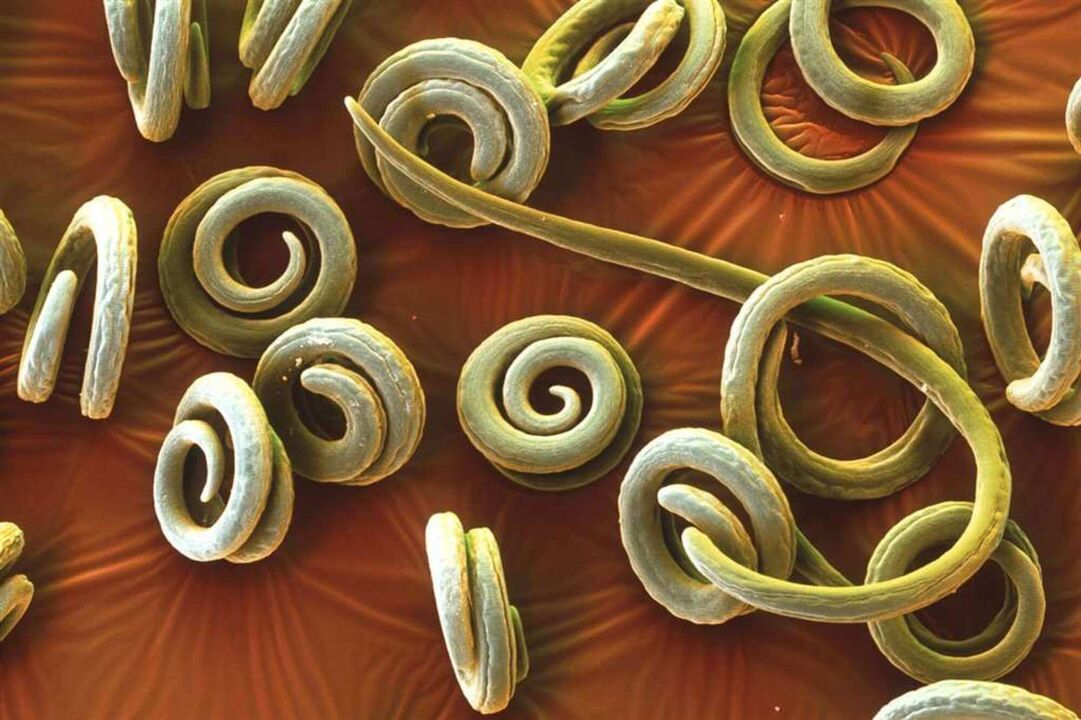 паразитические черви в организме человека