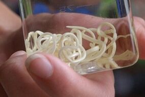 паразиты человеческого организма